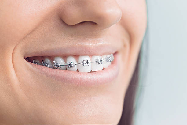 Best Teeth Whitening  in Hebron, OH